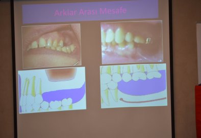 22.12.2018 Hilton Garden Inn/Eskişehir Dental İmplant Lansman Toplantısı/'Implant Üstü Protezlerde Komplikasyonlar ve Çözümleri" Eğitimi